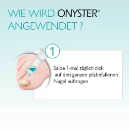 ONYSTER Nagelset, 1 pcs